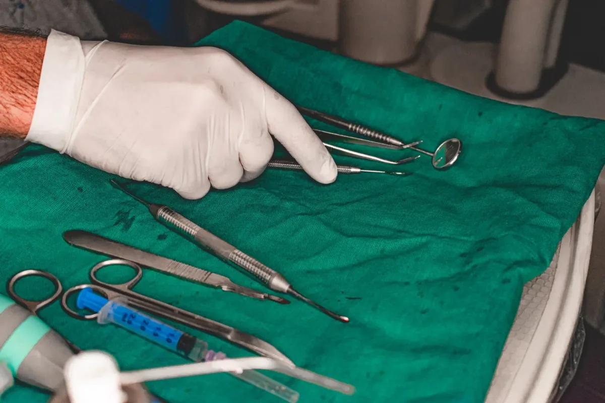 Full-Arch Implants: What to Expect