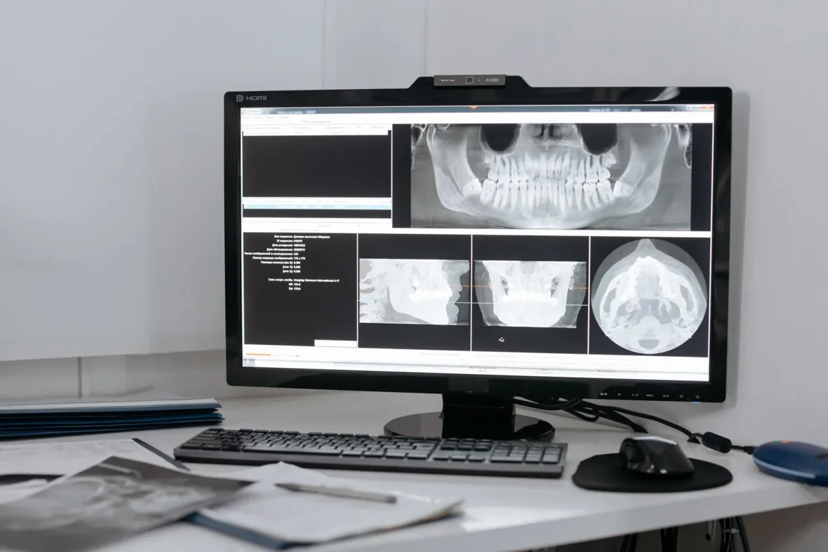Prosthodontist or General Dentist for Implants?
