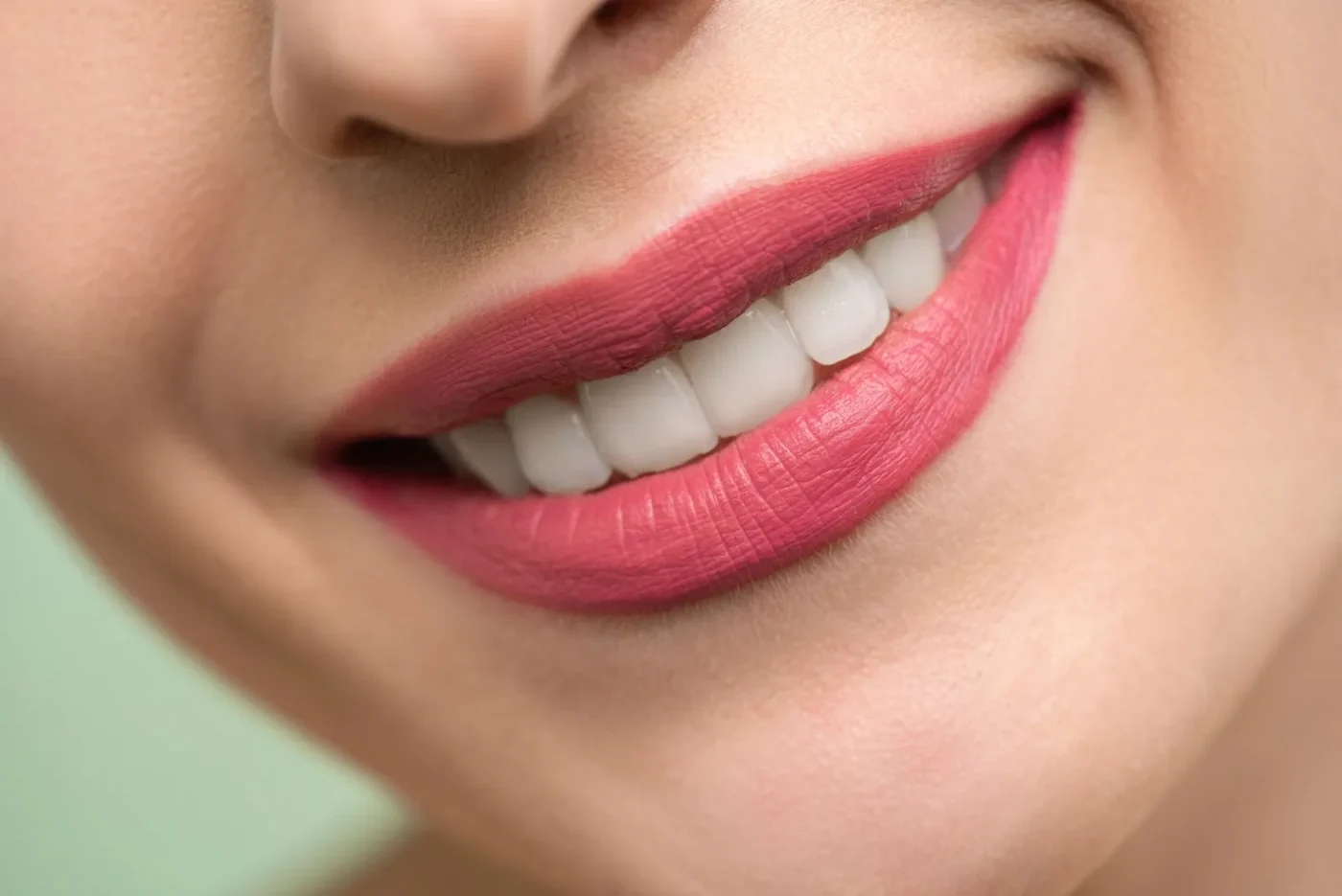 Porcelain Veneers