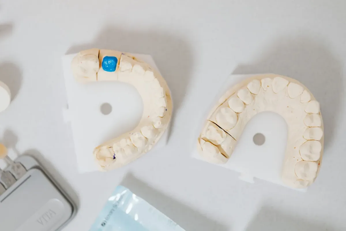 Tooth-Colored Fillings