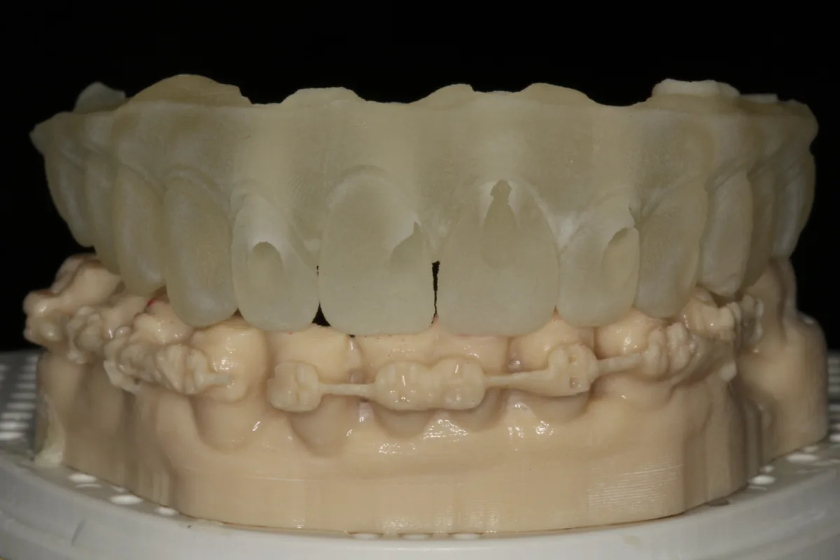 Dental models and trial teeth in the laboratory